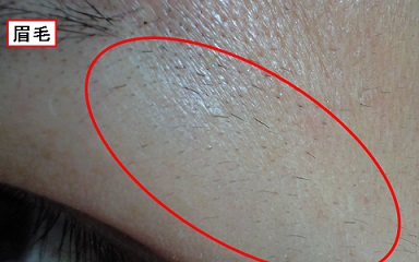 �A���V�A�N���j�b�N�̔��E�сB�����ׂ̍����т�E��